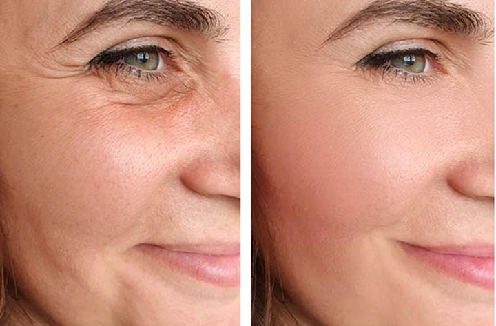 What You Need to Know About Non-Surgical Skin Rejuvenation